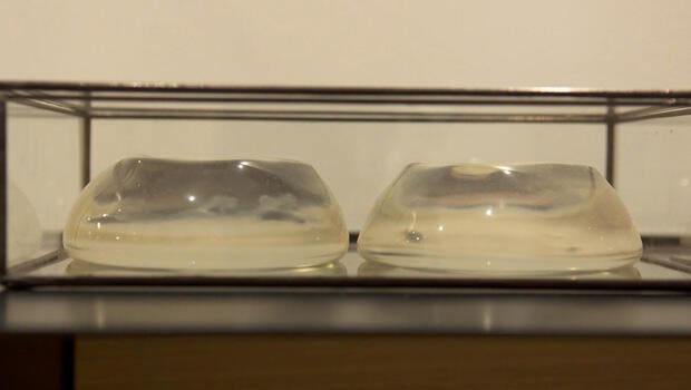 museum-of-broken-relationships-silicone-implants-620.jpg