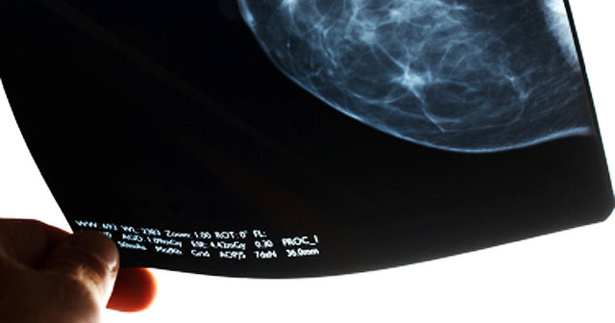 Think you're too old for a mammogram? Think again, study suggests - CBS News