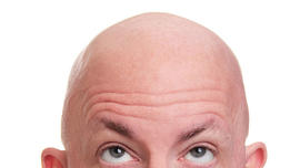 bald man