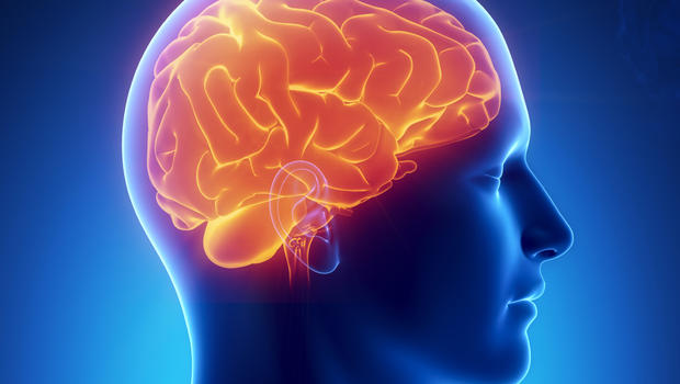 What could cause a stroke in the brain?