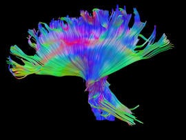 traumatic brain injuries scan