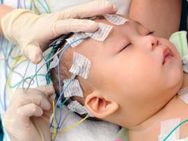 electroencephalography, eeg, electroencephalogram, brain scan, toddler, infant, stock, 4x3
