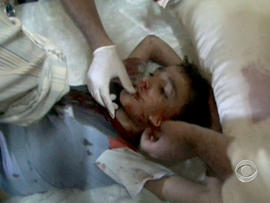 syria, wounded, boy, medical battalion, medics