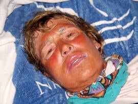 Diana Nyad