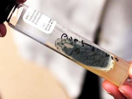 This is the fungus inside patients who were injected with tainted steroids made by NECC. This sample was grown from the spinal fluid of a patient.