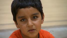 Six-year-old Sajad was badly injured in Afghanistan when a bomb went off next to his home.