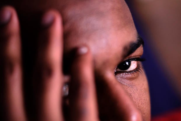 Racist violence victim Omar, 28, from Guinea, hides his face as he talks to AFP