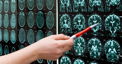 How Smart Are You? Patterns of Brain Activity Might Hold Clues
