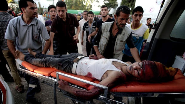 palestinians-wounded.jpg
