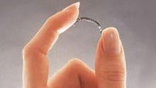 essure.jpg