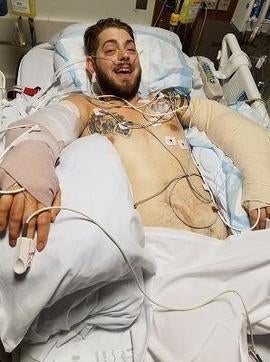 john-peck-after-arm-transplant.jpg