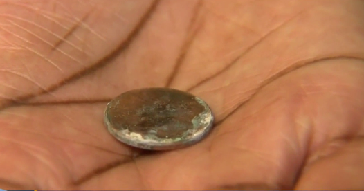 Mom: Coin stuck in baby's throat for 37 days before docs noticed - CBS News