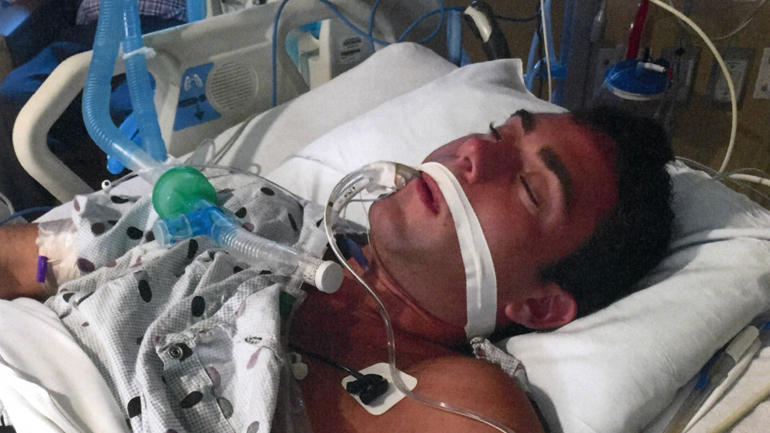 jake-nolan-coma.jpg