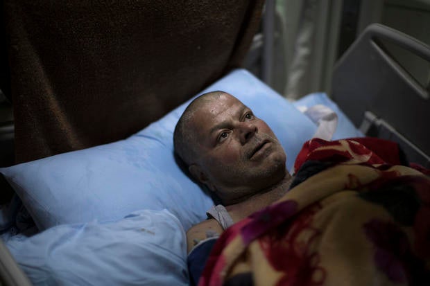 mosul-airstrike-survivor-ap-17100645538423.jpg