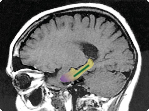 brain-scan-flavonol-study.jpg