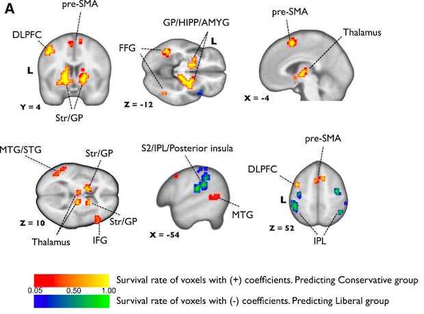 fmri-disgust.png