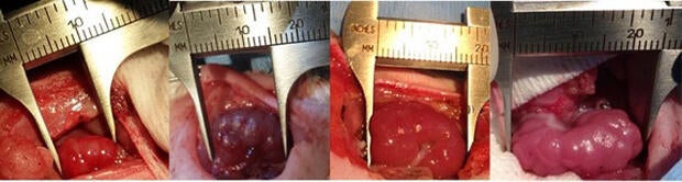 kidney-growth-620w.jpg