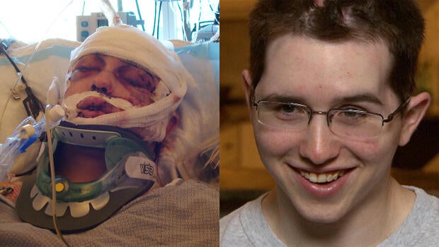 back-to-life-before-and-after-620.jpg