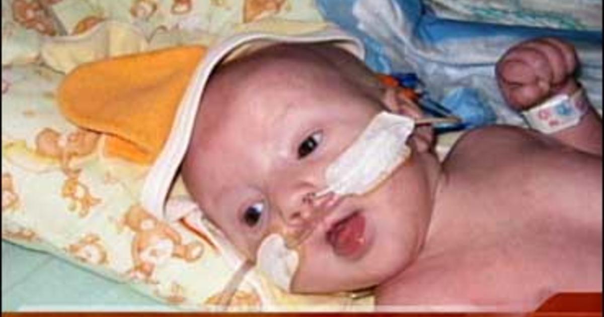 Miracle Baby Survives Off Life Support CBS News