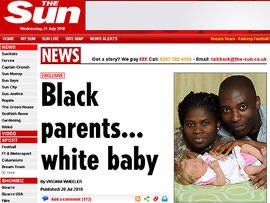 Black parents say they gave birth to white baby.