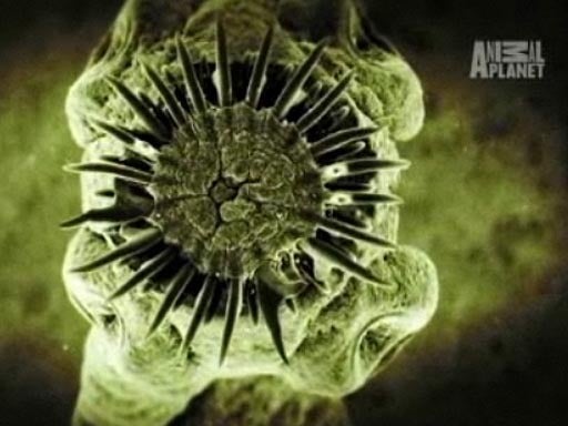 Pork_Tapeworm.jpg