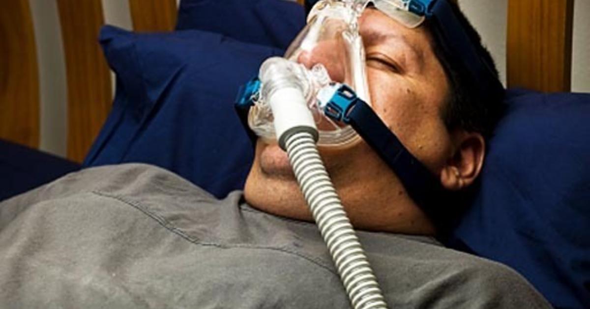 Sleep Apnea Cpap Treatment May Lower Heart Disease Diabetes Risk Cbs