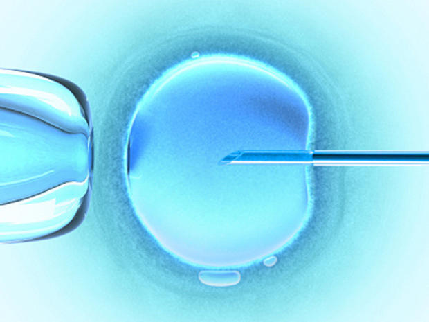 ivf, in vitro fertilization 
