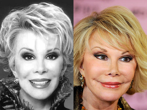 JoanRivers-beforeafter.jpg