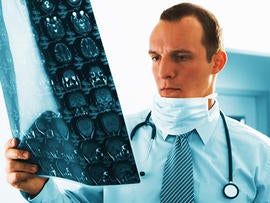 stroke, doctor, brain, scan, istockphoto, 4x3