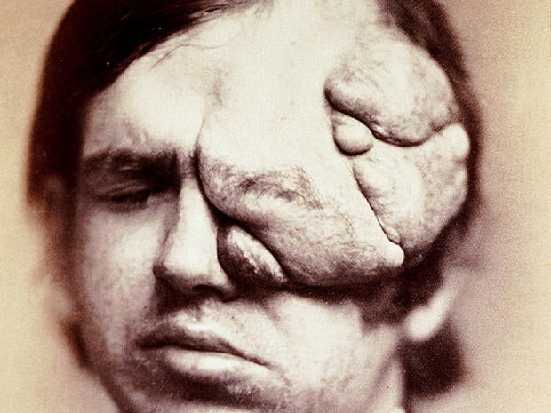 Eye care in the 1800s: 14 shocking photos 
