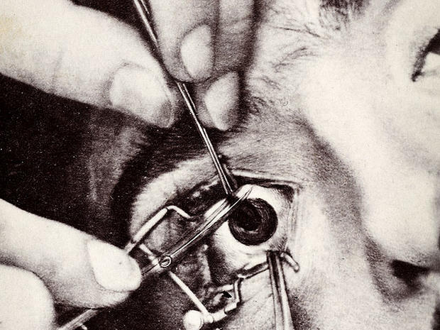 Eye care in the 1800s: 14 shocking photos 