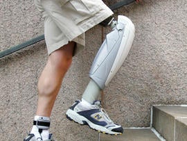 Mass. man with fake leg takes down alleged thief