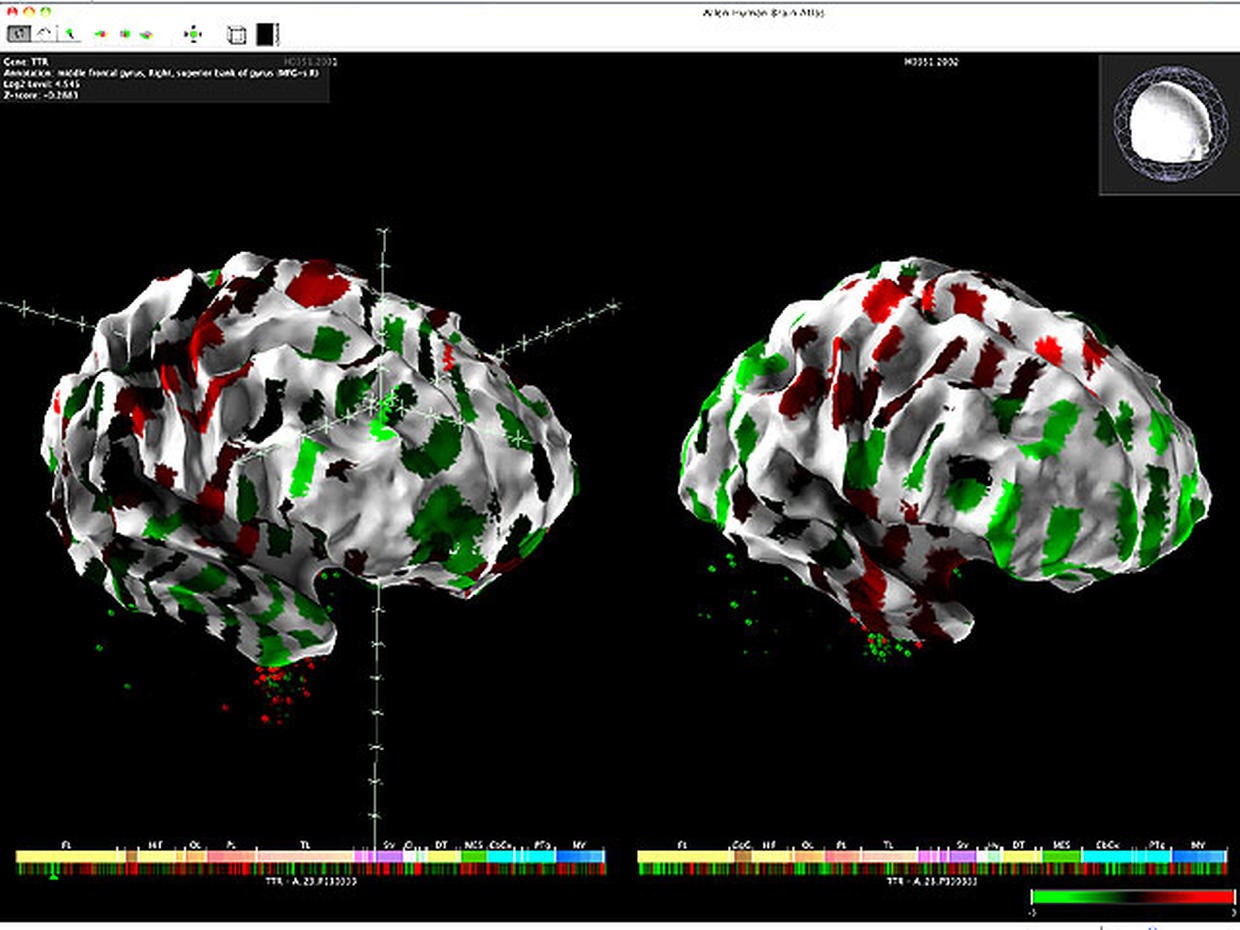 GPS for the brain? New brain atlas wows scientists Photo 10