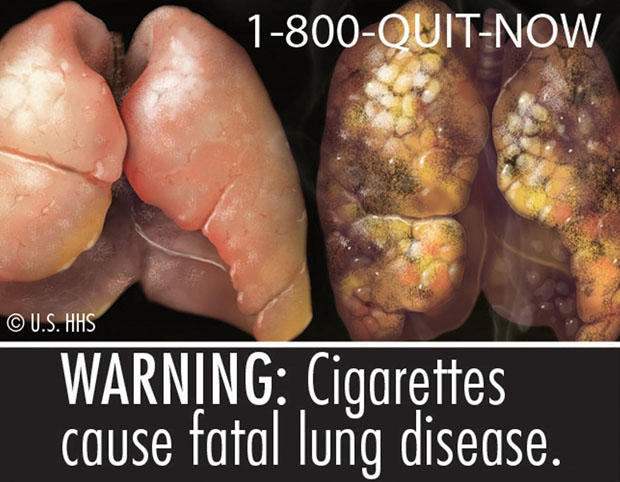 fda-cigarette-warning-labels-7.jpg 