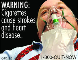 Cigarettes cause strokes and heart disease