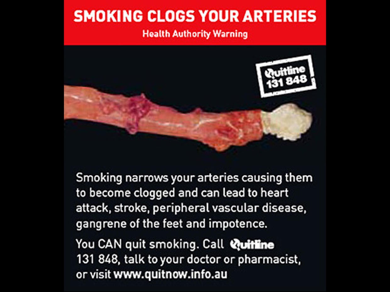 Australia's graphic tobacco warning labels Photo 1 CBS News