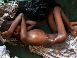Misery in Somalia
