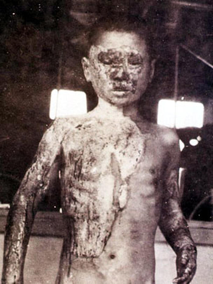 hiroshima aftermath hiroshima aftermath