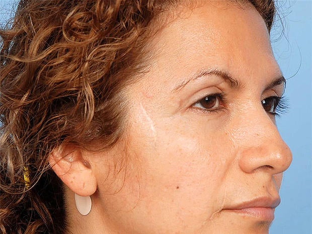 Dinora Rodriquez, American Society of Plastic Surgeons, "Do your homework" campaign