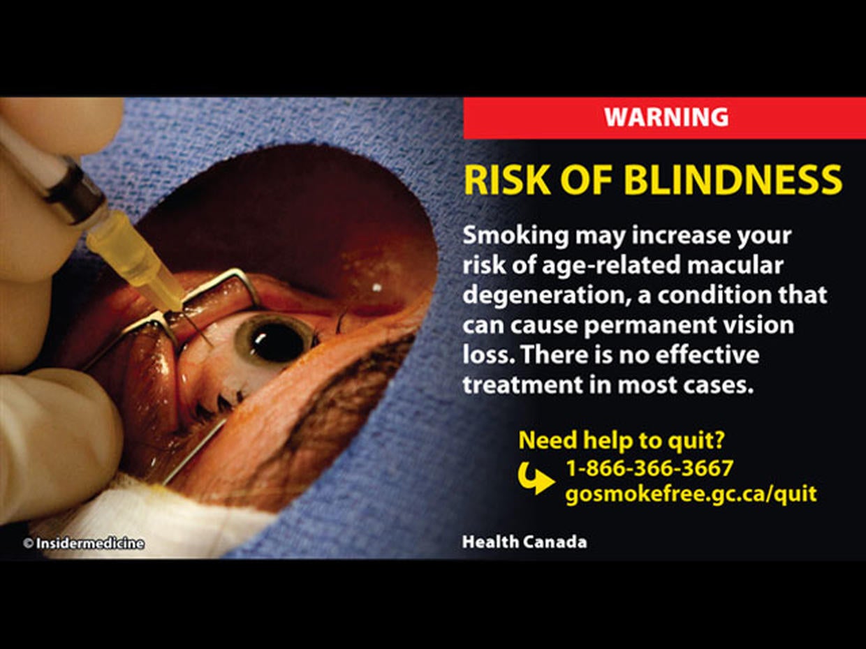 Yikes! Gruesome new tobacco warning labels from Canada Photo 1 CBS News