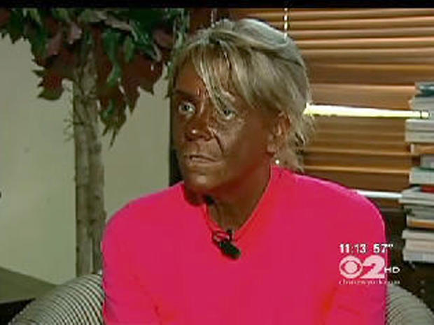 'Tanning mom' Patricia Krentcil banned from over 60 tanning salons, says report 