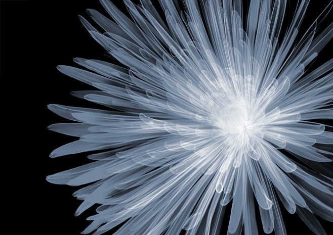 Incredible xray art