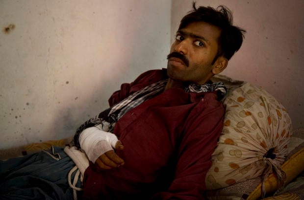 Barber Elias, 25, a Pakistani Christian who was beaten by radical Muslims in the Joseph Colony