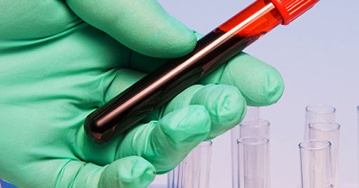 testing artificial urine samples testing artificial urine samples