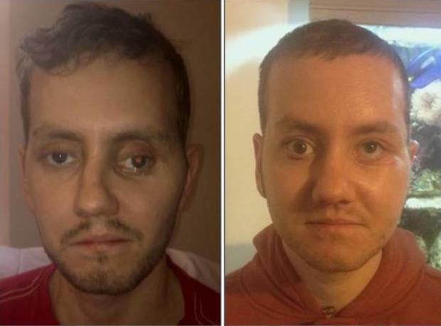 001-b4-and-after.jpg