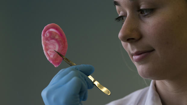 London scientists grow noses and ears 