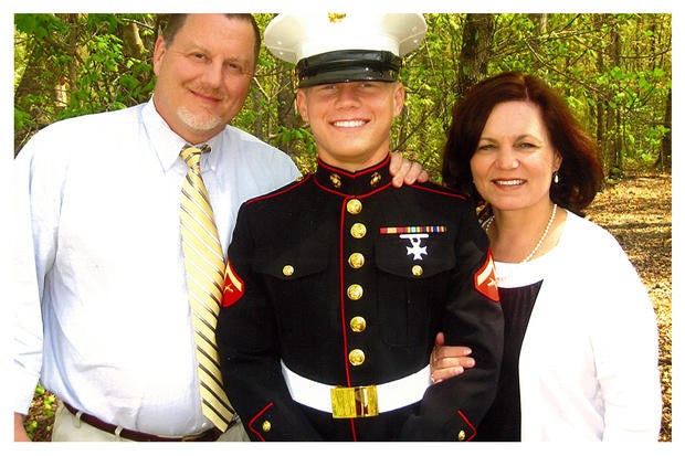 Kyle carpenter before and after surgery are Have Kyle carpenter before and after surgery opinion