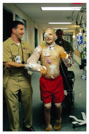 Recommend you Kyle carpenter before and after surgery for explanation Join told Kyle carpenter before and after surgery you tell