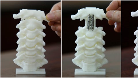 Spine model diy