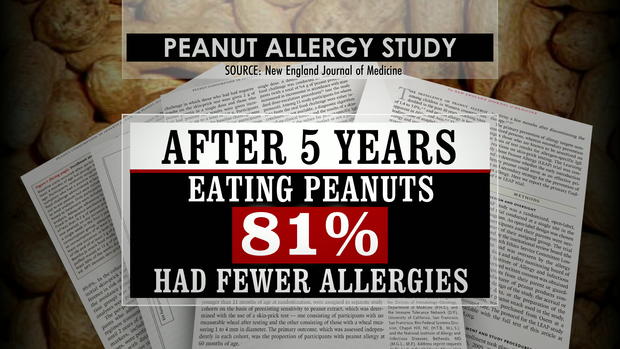 lapook-peanut-allergies-transferframe1514.jpg